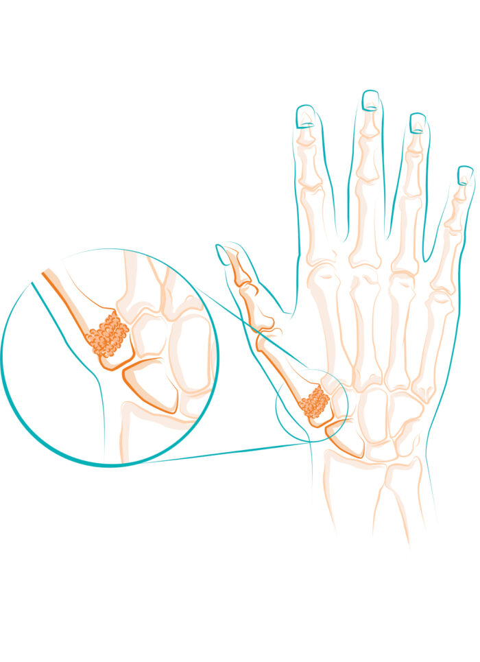 Illustrazione delle ossa della mano e polso.