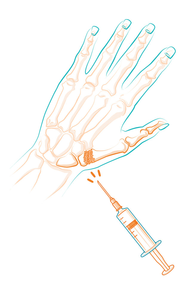 Skelett einer Hand mit Spritze